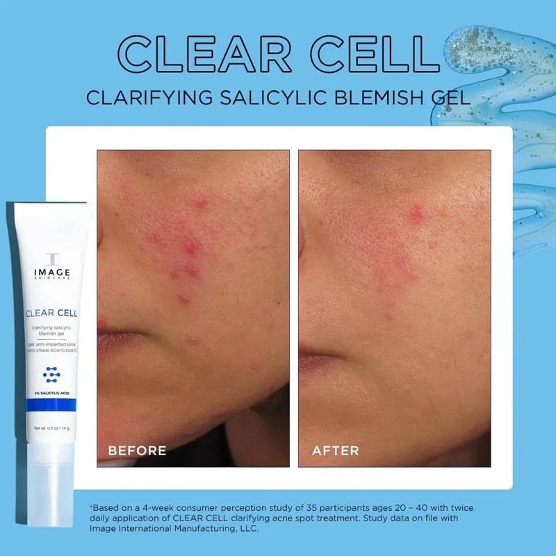 Gel Chấm Mụn Image Clear Cell Clarifying Salicylic Blemish 14g CT - Ảnh 4